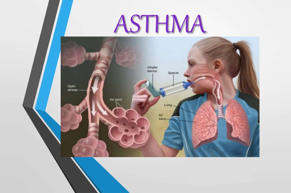 Asthma